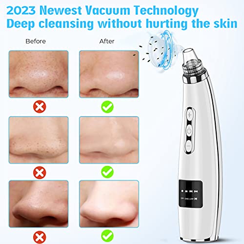 2023-Newest-Blackhead-Remover-Pore-VacuumUpgraded-Facial-Pore-CleanerElectric-Acne-Comedone-Whitehead-Extractor-Tool-5-Suction-Power5-ProbesUSB-Rechargeable-Blackhead-Vacuum-Kit-for-Women-Men-0-3