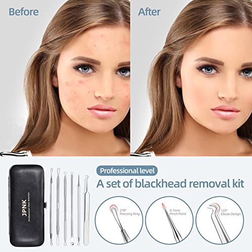 JPNK-Blackhead-Remover-Tool-Comedones-Extractor-Acne-Removal-Kit-for-Blemish-Whitehead-Popping-6-Pcs-Zit-Removing-for-Nose-Face-Tools-with-a-Leather-Bag-0-1