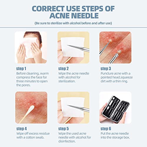 JPNK-Blackhead-Remover-Tool-Comedones-Extractor-Acne-Removal-Kit-for-Blemish-Whitehead-Popping-6-Pcs-Zit-Removing-for-Nose-Face-Tools-with-a-Leather-Bag-0-2